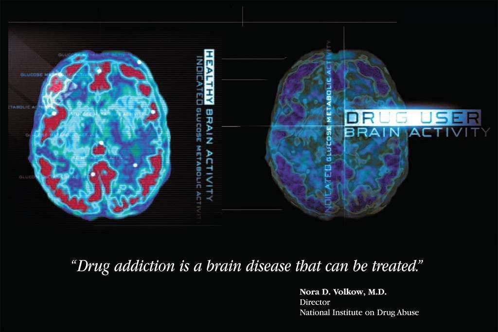 drug brain activity b51410 10247807239904541101235