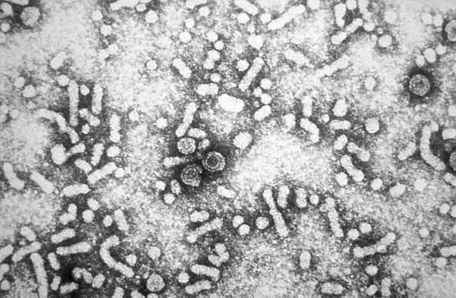 hepatitis b virions 08687e 6408890295124819006623